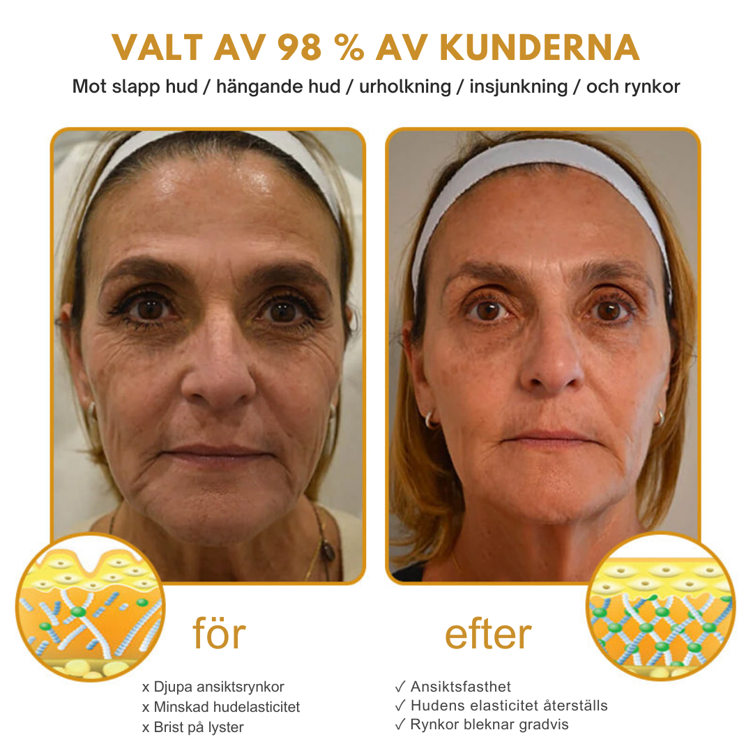 AntiRynk™ | Botox Rynkborttagningskräm