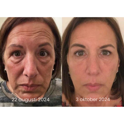 AntiRynk™ | Botox Rynkborttagningskräm