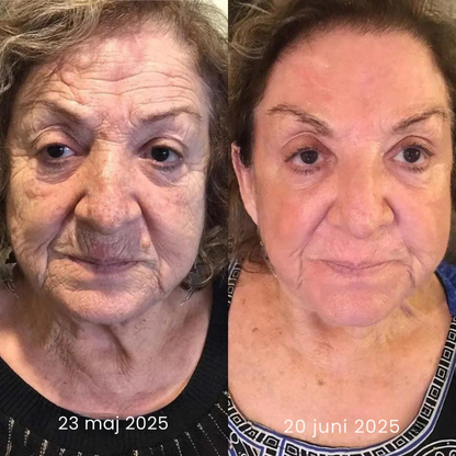 AntiRynk™ | Botox Rynkborttagningskräm